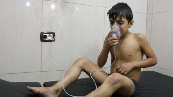 По меньшей мере 80 человек пострадали в результате атаки с использованием ядовитого газа хлора в пригороде Алеппо. 