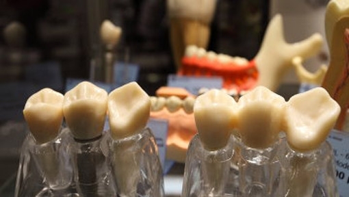 В Санкт-Петербурге стоматолог частной клиники удалила пациентке 22 здоровых зуба, чтобы заработать более 800 тыс. рублей. 