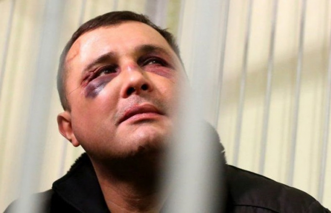Печерский районный суд города Киеве 10 февраля избрал для бывшего народного депутата Александра Шепелева мера пресечения в виде содержания под стражей до 8 апреля. 