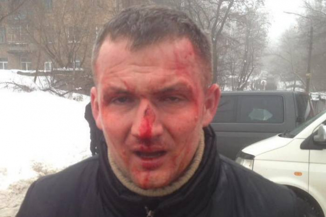 По факту избиения депутата Верховной Рады Юрия Левченко (партия "Свобода") правоохранители начали уголовное производство по ч. 2 ст. 296 "Хулиганство". 