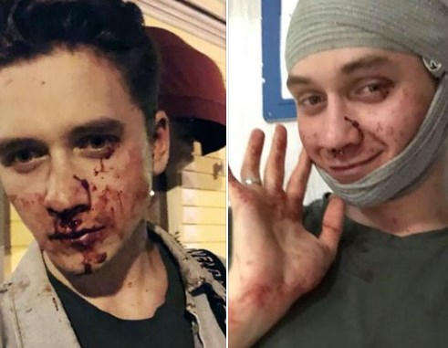 В Киеве в ночь на 12 августа группа неизвестных лиц, угрожая оружием, совершила нападение на двух молодых людей, якобы, из-за их "ориентацию". 